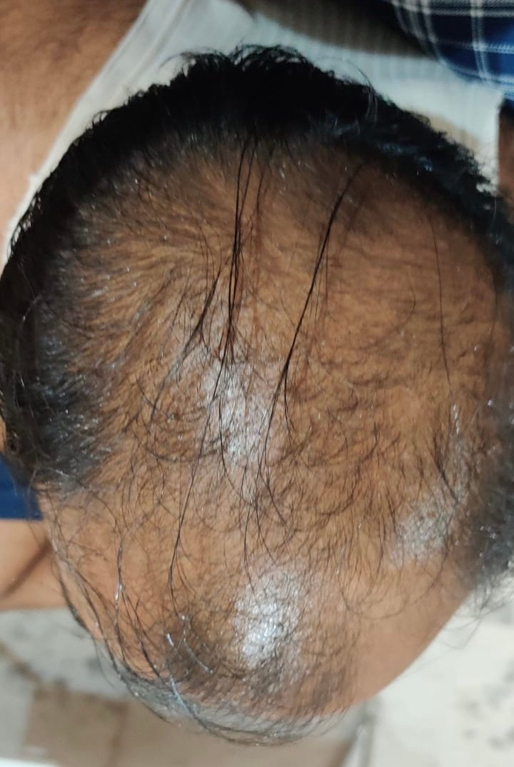 Before using Ancient Rishi