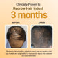 Before and after hair growth treatment showing a person's head with hair loss on the left and regrowth on the right, set against a beige background.